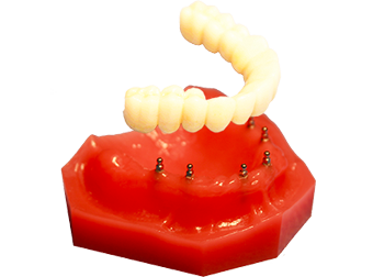 mini dental implants Hartland, WI